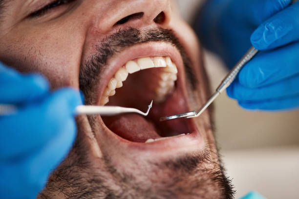Best Cracked Tooth Emergency Dentist  in Towanda, PA